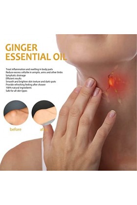 Huile De Gingembre De Drainage Lymphatique, 2 Pièces Dhuile De Gingembre De Massage Lymphatique 10 Ml Soulage le Gonflement 