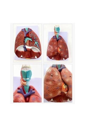 SUCHUANGUANG Modèle Anatomique de poumon Humain pour létude des Maladies modèle danatomie du cœur des poumons et de la Gorg
