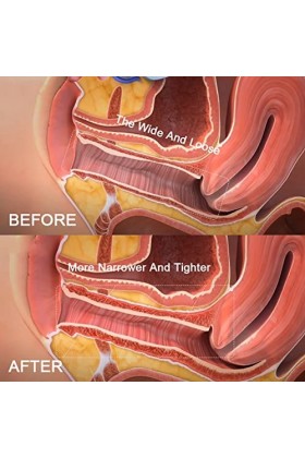 Gel raffermissant vaginal, sérum raffermissant vaginal Des ingrédients doux augmentent la flexibilité avec des tubes en coton