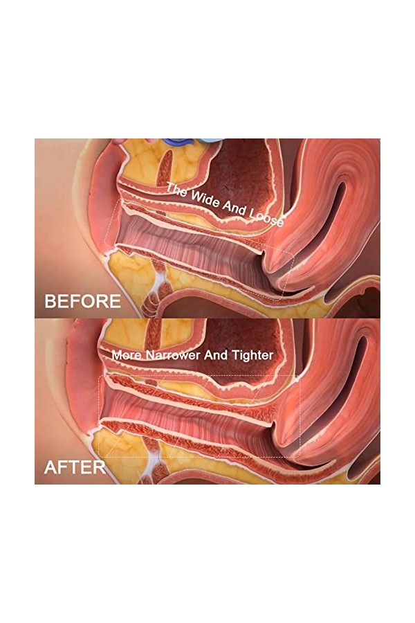 Gel raffermissant vaginal, sérum raffermissant vaginal Des ingrédients doux augmentent la flexibilité avec des tubes en coton